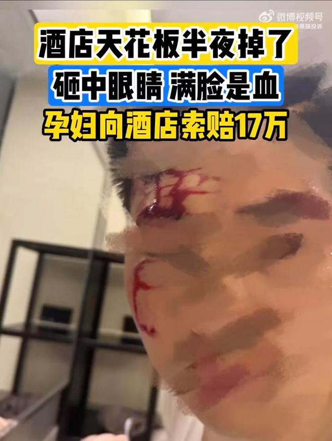 男子苏州住高端酒店半夜被吊顶砸伤后索赔17万酒店：客人已送医赔偿需协商(图1)